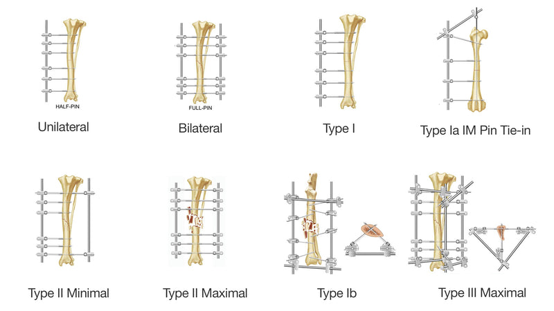 External Skeletal Fixation Nomenclature