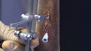 SK ESF System | Clamp Placement