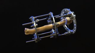 SK ESF System | Historical Overview